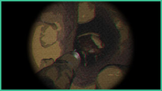 The inside of an ear canal in Tiny Chills Not From Ear. There is a strange insect in the shadows. The inside of an ear canal in Tiny Chills Not From Ear. There is a strange insect in the shadows.